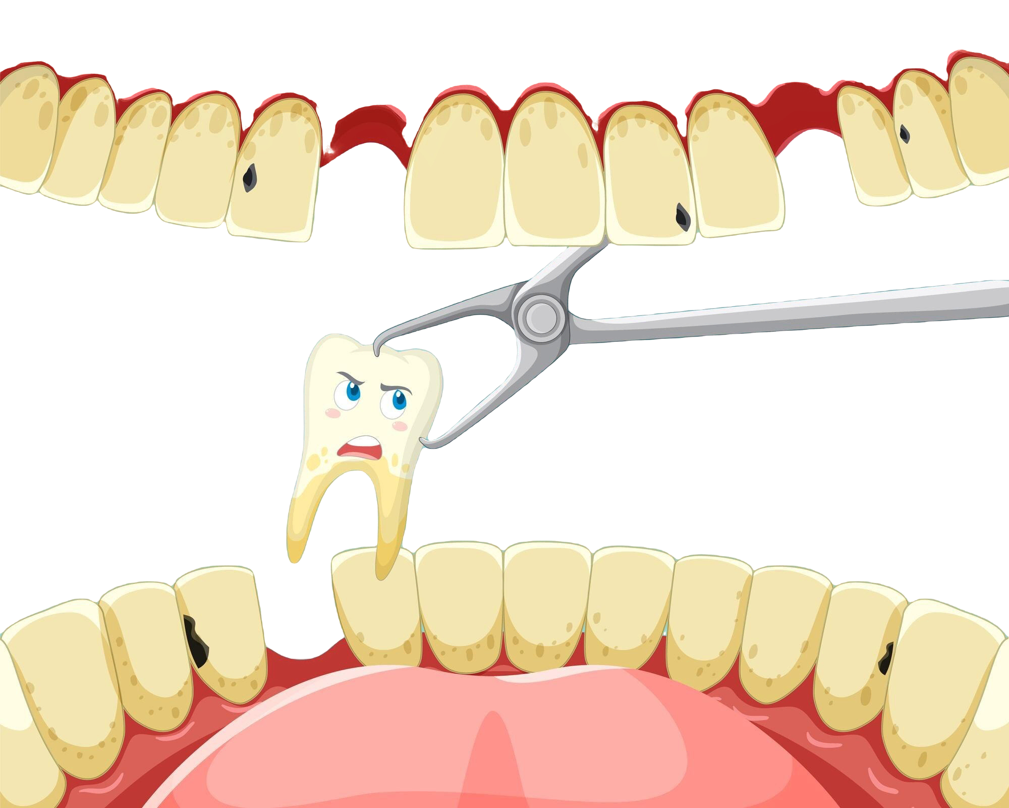 Extractions